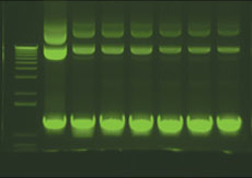 DNA SYBR stained Gel on Transilluminator (23,433 bytes)