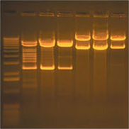 DNA Ethidium Bromide stained Gel on Transilluminator (28,448 bytes)